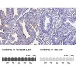 FAM166B Antibody, Novus Biologicals:Antibodies:Primary Antibodies